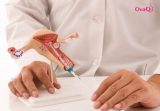 Kinh nghiệm các mẹ làm iui thành công